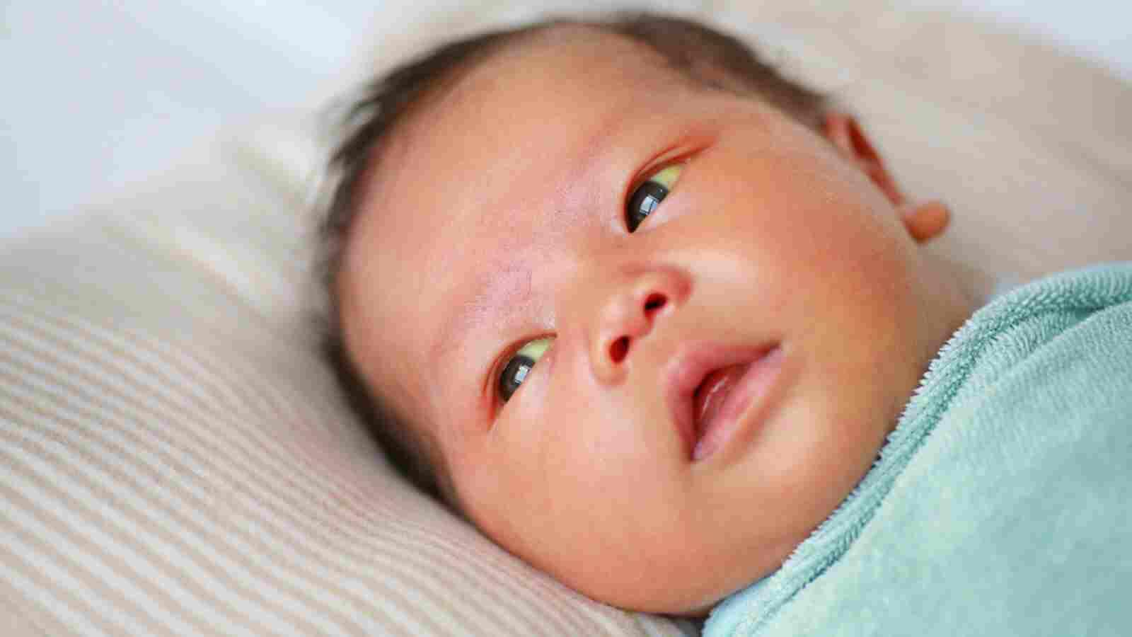 اصفرار الوجه عند الأطفال الأسباب، الأعراض، العوامل المسببّة له، العلاج البوابة